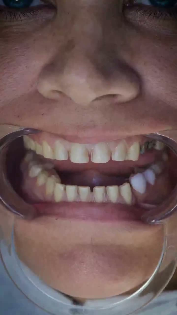 Hasta videosu