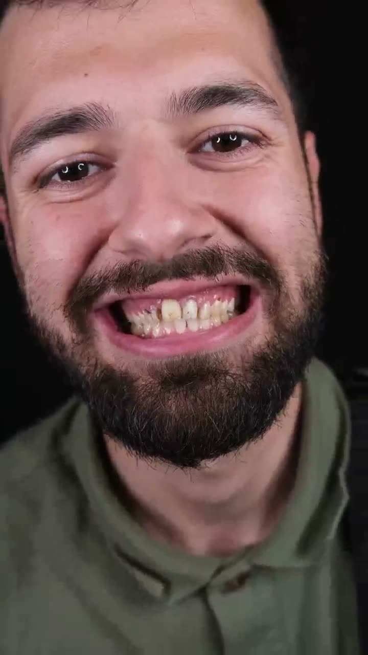 Hasta videosu